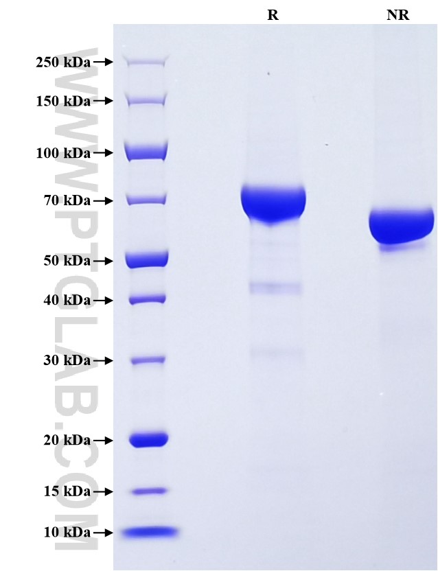 Purity of Recombinant Human Alpha-fetoprotein was determined by SDS-PAGE. The protein was resolved in an SDS-PAGE in reducing (R) and non-reducing (NR) conditions and stained using Coomassie blue.