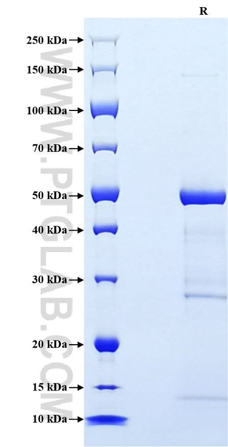 Purity of Recombinant Mouse CRP Protein was determined by SDS-PAGE. The protein was resolved in an SDS-PAGE in reducing (R) conditions and stained using Coomassie blue.