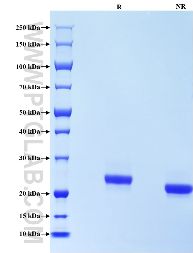 Purity of Recombinant Mouse Lipocalin-2 was determined by SDS-PAGE. The protein was resolved in an SDS-PAGE in reducing (R) and non-reducing (NR) conditions and stained using Coomassie blue.