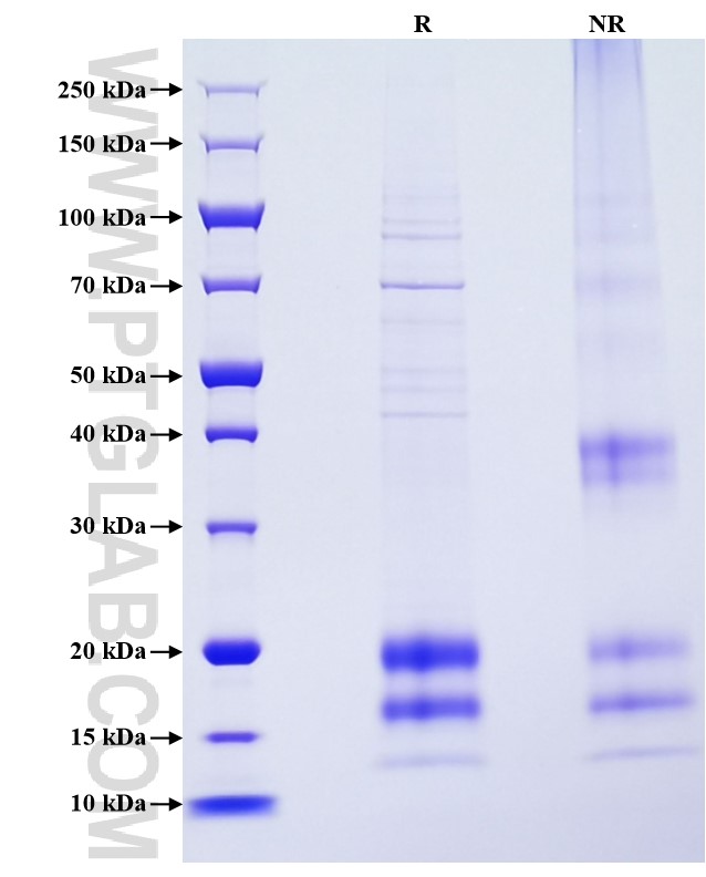 Purity of Recombinant Mouse MIF was determined by SDS-PAGE. The protein was resolved in an SDS-PAGE in reducing (R) and non-reducing (NR) conditions and stained using Coomassie blue.