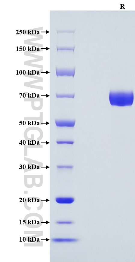 Purity of Recombinant Human IL-12 was determined by SDS-PAGE. The protein was resolved in an SDS-PAGE in reducing (R) conditions and stained using Coomassie blue.