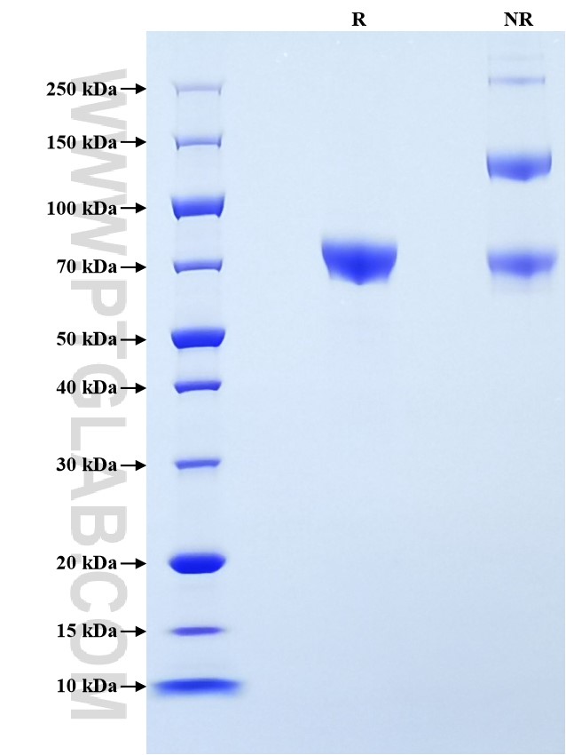 Purity of Recombinant Human Endoglin was determined by SDS-PAGE. The protein was resolved in an SDS-PAGE in reducing (R) and non-reducing (NR) conditions and stained using Coomassie blue.