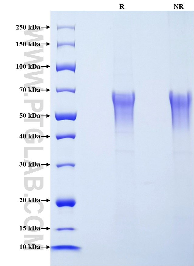Purity of Recombinant Rat KIM-1 was determined by SDS-PAGE. The protein was resolved in an SDS-PAGE in reducing (R) and non-reducing (NR) conditions and stained using Coomassie blue.