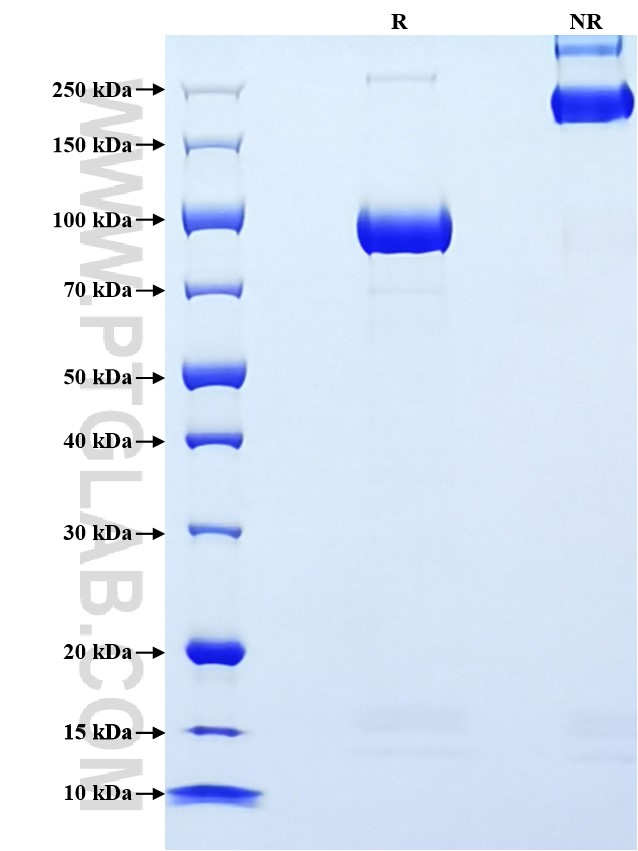 Purity of Recombinant Human IL-12 (linked heterodimer) was determined by SDS-PAGE. The protein was resolved in an SDS-PAGE in reducing (R) and non-reducing (NR) conditions and stained using Coomassie blue. Purity of Recombinant Human IL-12 (linked heterodimer) was determined by SDS-PAGE. The protein was resolved in an SDS-PAGE in reducing (R) and non-reducing (NR) conditions and stained using Coomassie blue.