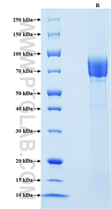 Purity of Recombinant Mouse E-Selectin was determined by SDS-PAGE. The protein was resolved in an SDS-PAGE in reducing (R) conditions and stained using Coomassie blue.