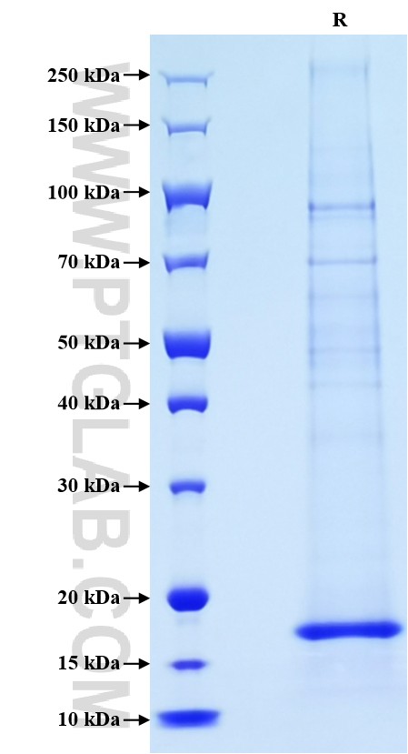 Purity of Recombinant Human IL21 was determined by SDS-PAGE. The protein was resolved in an SDS-PAGE in reducing (R) condition and stained using Coomassie blue.