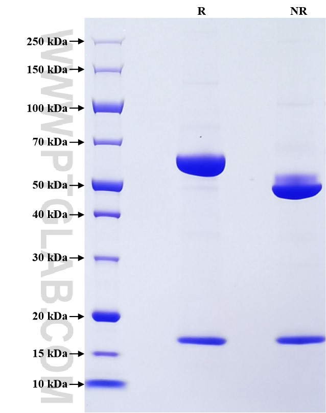 Purity of Recombinant Mouse PCSK9 was determined by SDS-PAGE. The protein was resolved in an SDS-PAGE in reducing (R) and non-reducing (NR) conditions and stained using Coomassie blue.