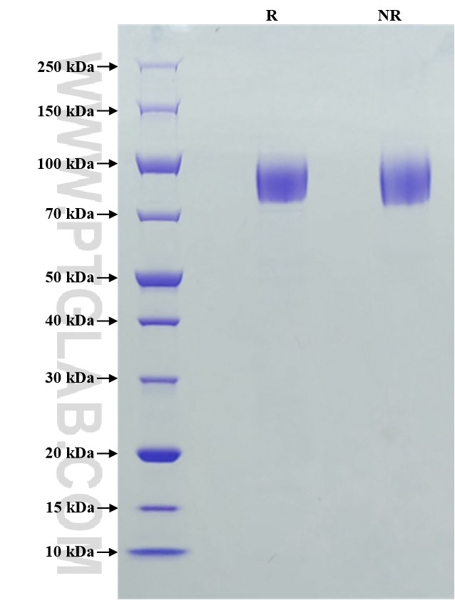 Purity of Recombinant Human gp130 was determined by SDS-PAGE. The protein was resolved in an SDS-PAGE in reducing (R) and non-reducing (NR) conditions and stained using Coomassie blue.