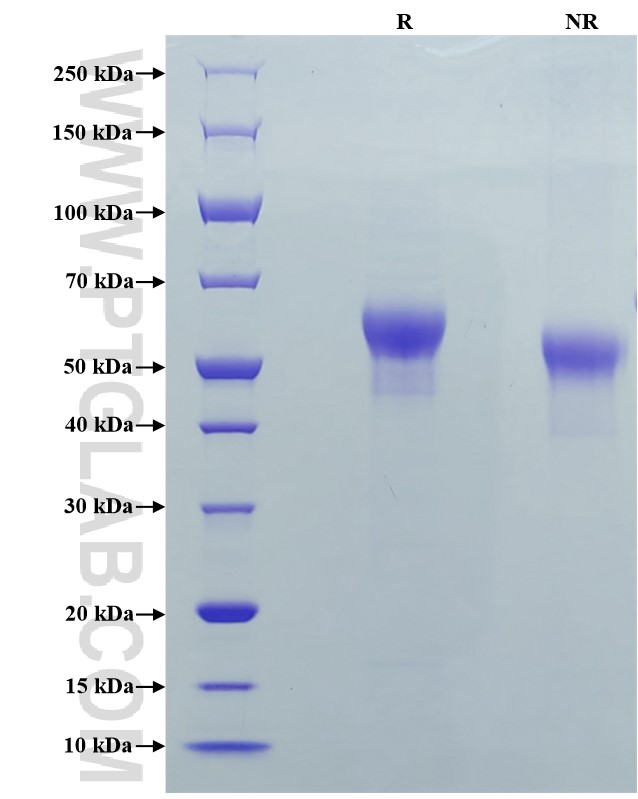 Purity of Recombinant Mouse IL-6R alpha was determined by SDS-PAGE. The protein was resolved in an SDS-PAGE in reducing (R) and non-reducing (NR) conditions and stained using Coomassie blue.