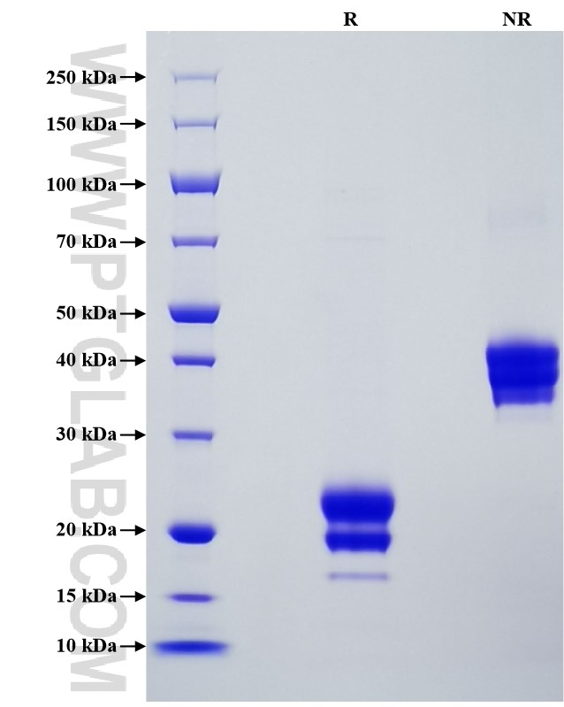 Purity of Recombinant Mouse IL-17F was determined by SDS-PAGE. The protein was resolved in an SDS-PAGE in reducing (R) and non-reducing (NR) conditions and stained using Coomassie blue.