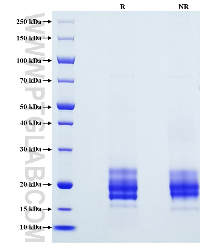 Purity of Recombinant Mouse Flt3 ligand was determined by SDS-PAGE. The protein was resolved in an SDS-PAGE in reducing (R) and non-reducing (NR) conditions and stained using Coomassie blue.