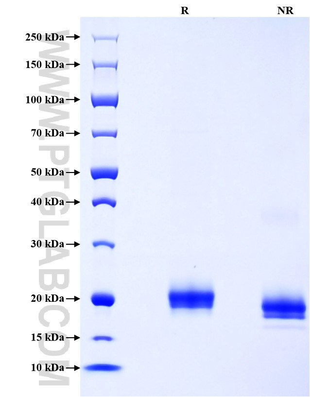 Purity of Recombinant Mouse Interferon alpha 1 was determined by SDS-PAGE. The protein was resolved in an SDS-PAGE in reducing (R) and non-reducing (NR) conditions and stained using Coomassie blue. Purity of Recombinant Mouse Interferon alpha 1 was determined by SDS-PAGE. The protein was resolved in an SDS-PAGE in reducing (R) and non-reducing (NR) conditions and stained using Coomassie blue.