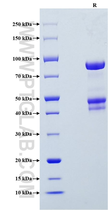 Purity of Recombinant Human Osteopontin was determined by SDS-PAGE. The protein was resolved in an SDS-PAGE in reducing (R) conditions and stained using Coomassie blue. Purity of Recombinant Human Osteopontin was determined by SDS-PAGE. The protein was resolved in an SDS-PAGE in reducing (R) conditions and stained using Coomassie blue.