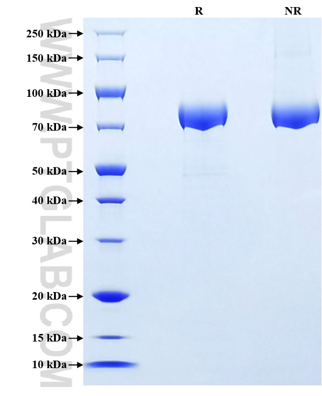 Purity of Recombinant Human N-Cadherin was determined by SDS-PAGE. The protein was resolved in an SDS-PAGE in reducing (R) and non-reducing (NR) conditions and stained using Coomassie blue.