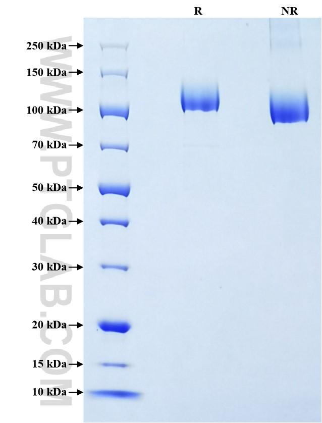 Purity of Recombinant Mouse VEGFR2 was determined by SDS-PAGE. The protein was resolved in an SDS-PAGE in reducing (R) and non-reducing (NR) conditions and stained using Coomassie blue.