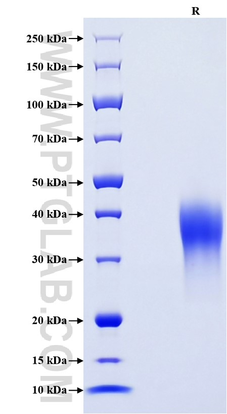 Purity of Recombinant Mouse LIF was determined by SDS-PAGE. The protein was resolved in an SDS-PAGE in reducing (R) conditions and stained using Coomassie blue. Purity of Recombinant Mouse LIF was determined by SDS-PAGE. The protein was resolved in an SDS-PAGE in reducing (R) conditions and stained using Coomassie blue.