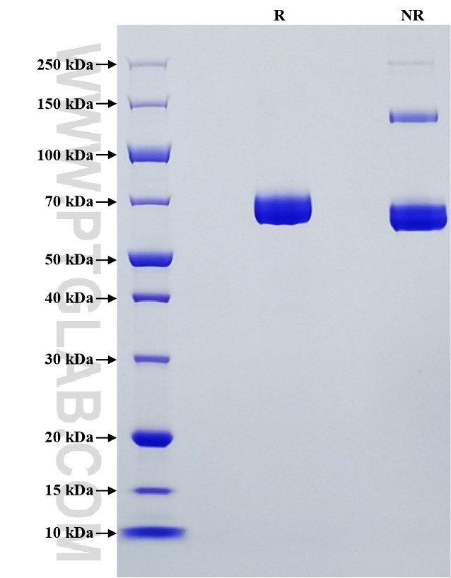 Purity of Recombinant Mouse IL-12 was determined by SDS-PAGE. The protein was resolved in an SDS-PAGE in reducing (R) and non-reducing (NR) conditions and stained using Coomassie blue.