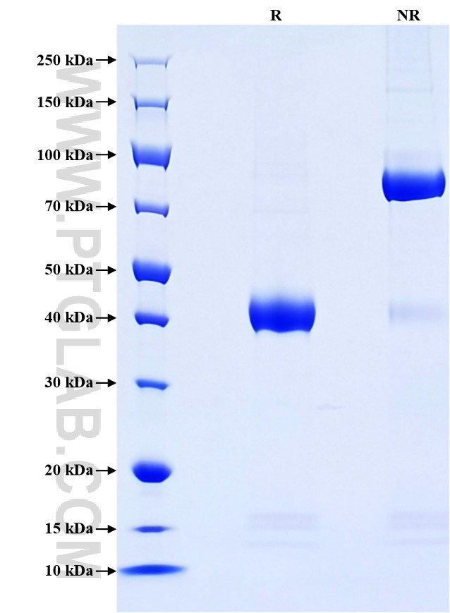 Purity of Recombinant Human B3GAT1 was determined by SDS-PAGE. The protein was resolved in an SDS-PAGE in reducing (R) and non-reducing (NR) conditions and stained using Coomassie blue.