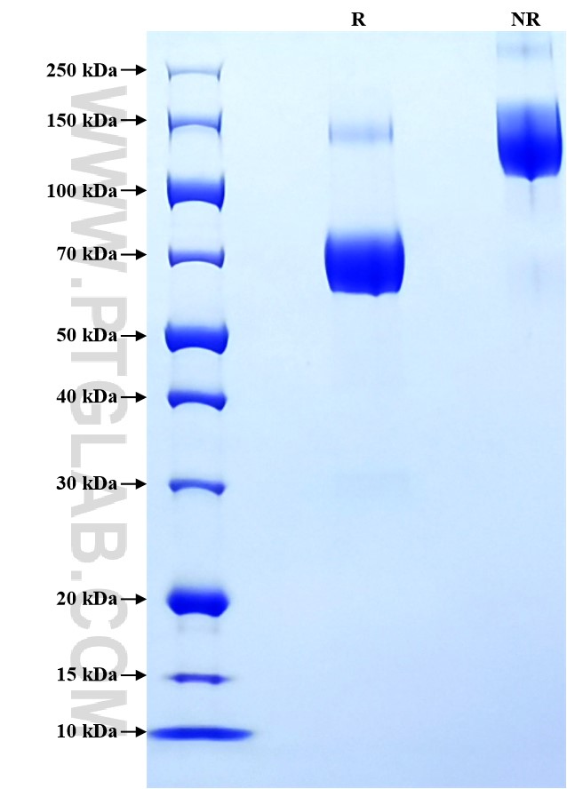Purity of Recombinant Mouse CD80 was determined by SDS-PAGE. The protein was resolved in an SDS-PAGE in reducing (R) and non-reducing (NR) conditions and stained using Coomassie blue. Purity of Recombinant Mouse CD80 was determined by SDS-PAGE. The protein was resolved in an SDS-PAGE in reducing (R) and non-reducing (NR) conditions and stained using Coomassie blue.