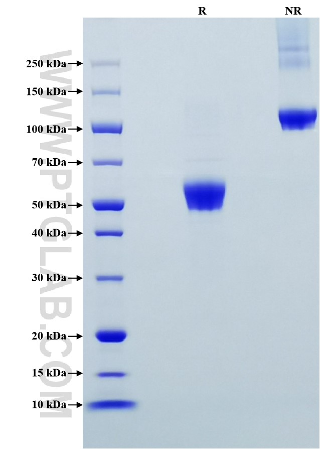 Purity of Recombinant Mouse CD28 was determined by SDS-PAGE. The protein was resolved in an SDS-PAGE in reducing (R) and non-reducing (NR) conditions and stained using Coomassie blue. Purity of Recombinant Mouse CD28 was determined by SDS-PAGE. The protein was resolved in an SDS-PAGE in reducing (R) and non-reducing (NR) conditions and stained using Coomassie blue.