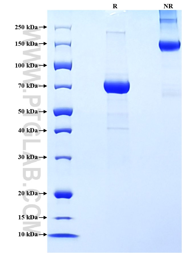 Purity of Recombinant Mouse IL-5RA was determined by SDS-PAGE. The protein was resolved in an SDS-PAGE in reducing (R) and non-reducing (NR) conditions and stained using Coomassie blue. Purity of Recombinant Mouse IL-5RA was determined by SDS-PAGE. The protein was resolved in an SDS-PAGE in reducing (R) and non-reducing (NR) conditions and stained using Coomassie blue.