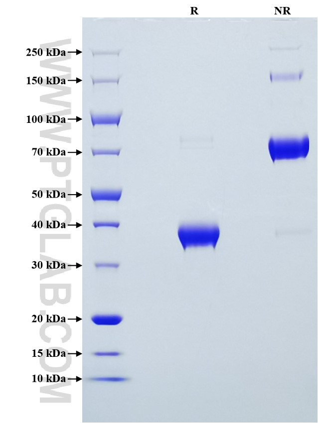 Purity of Recombinant Human BCMA was determined by SDS-PAGE. The protein was resolved in an SDS-PAGE in reducing (R) and non-reducing (NR) conditions and stained using Coomassie blue. Purity of Recombinant Human BCMA was determined by SDS-PAGE. The protein was resolved in an SDS-PAGE in reducing (R) and non-reducing (NR) conditions and stained using Coomassie blue.