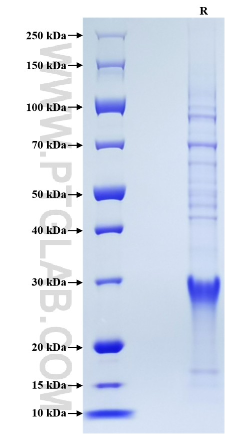 Purity of Recombinant Human CD8a was determined by SDS-PAGE. The protein was resolved in an SDS-PAGE in reducing (R) conditions and stained using Coomassie blue.