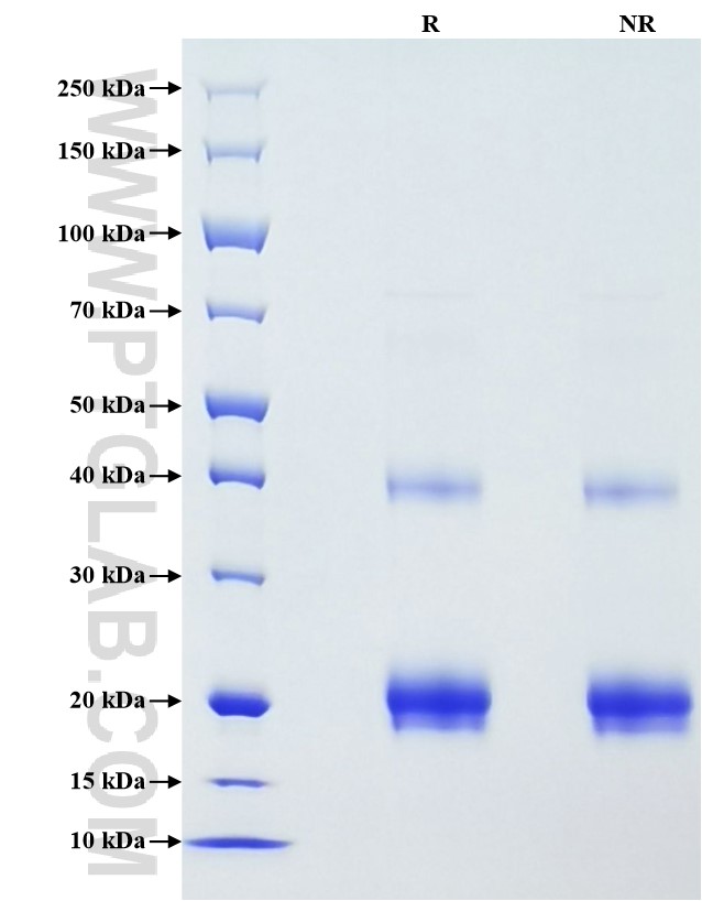 Purity of Recombinant Human TNF-beta was determined by SDS-PAGE. The protein was resolved in an SDS-PAGE in reducing (R) and non-reducing (NR) conditions and stained using Coomassie blue.