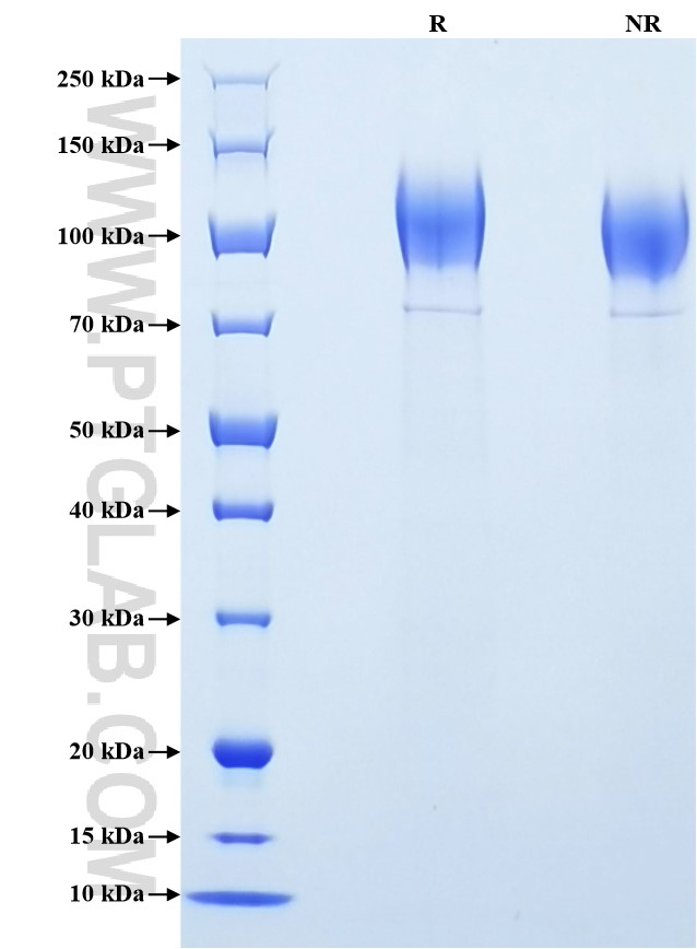 Purity of Recombinant Mouse CD45 was determined by SDS-PAGE. The protein was resolved in an SDS-PAGE in reducing (R) and non-reducing (NR) conditions and stained using Coomassie blue.