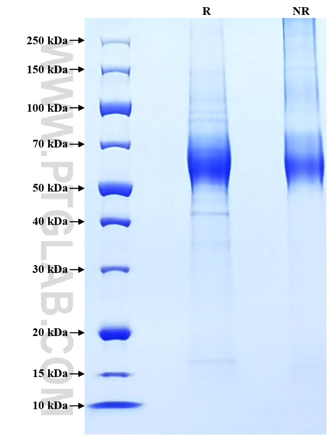 Purity of Recombinant Human IL-23R was determined by SDS-PAGE. The protein was resolved in an SDS-PAGE in reducing (R) and non-reducing (NR) conditions and stained using Coomassie blue.