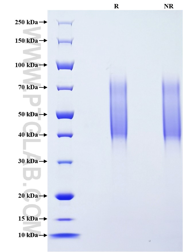 Purity of Recombinant Mouse CD34 was determined by SDS-PAGE. The protein was resolved in an SDS-PAGE in reducing (R) and non-reducing (NR) conditions and stained using Coomassie blue.