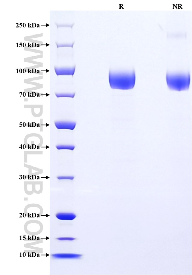 Purity of Recombinant Rat gp130 was determined by SDS-PAGE. The protein was resolved in an SDS-PAGE in reducing (R) and non-reducing (NR) conditions and stained using Coomassie blue.