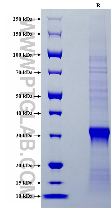 Purity of Recombinant Human KLK3/PSA was determined by SDS-PAGE. The protein was resolved in an SDS-PAGE in reducing (R) conditions and stained using Coomassie blue.