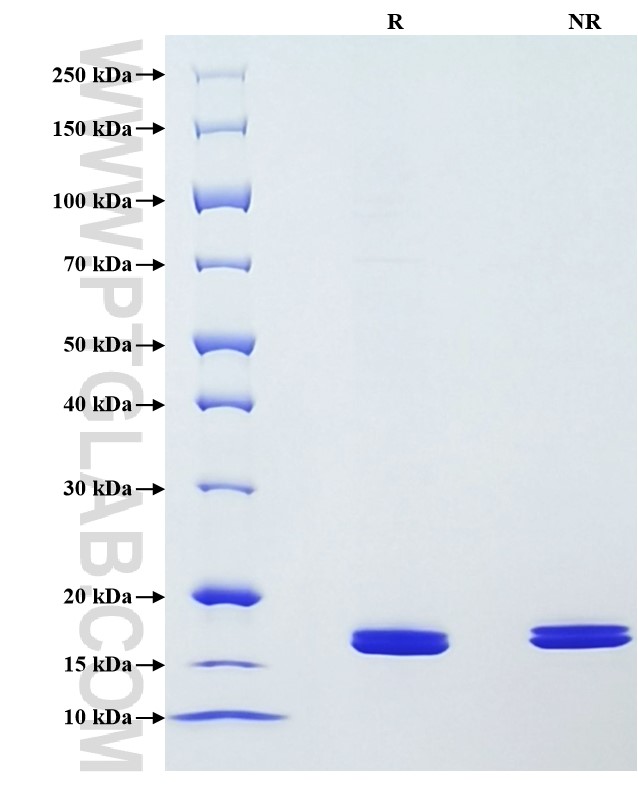 Purity of Recombinant Mouse Chemerin was determined by SDS-PAGE. The protein was resolved in an SDS-PAGE in reducing (R) and non-reducing (NR) conditions and stained using Coomassie blue.