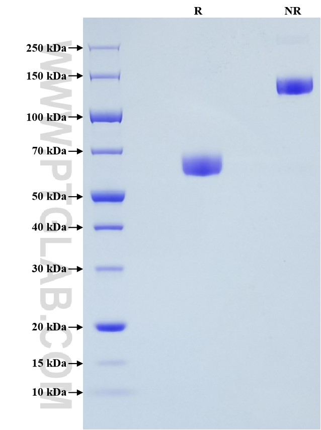 Purity of Recombinant Mouse CD200 was determined by SDS-PAGE. The protein was resolved in an SDS-PAGE in reducing (R) and non-reducing (NR) conditions and stained using Coomassie blue. Purity of Recombinant Mouse CD200 was determined by SDS-PAGE. The protein was resolved in an SDS-PAGE in reducing (R) and non-reducing (NR) conditions and stained using Coomassie blue.