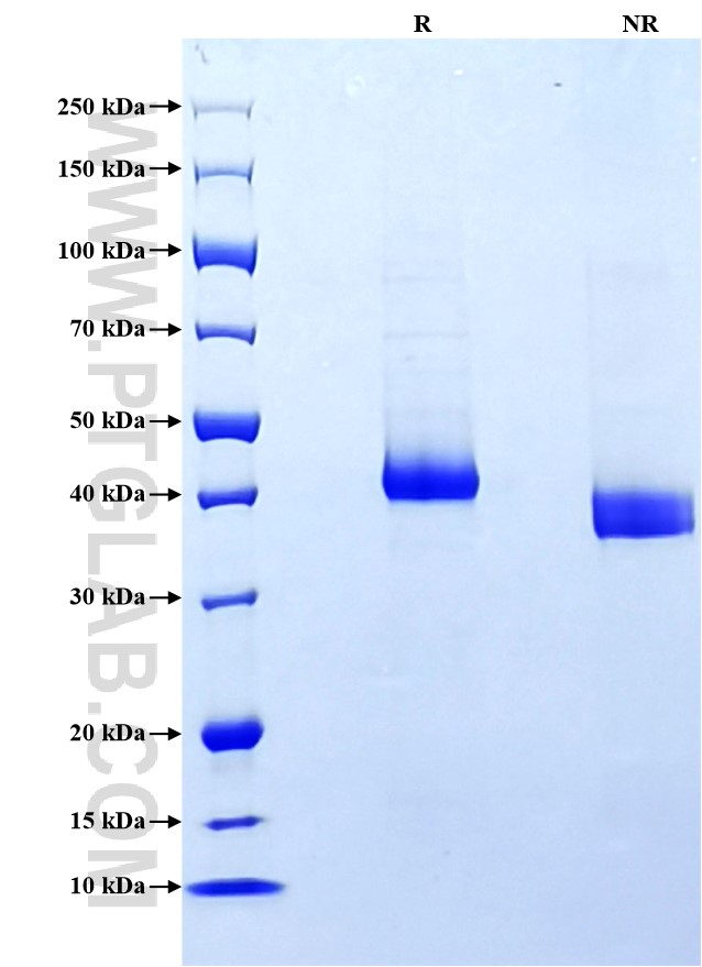Purity of Recombinant Rabbit CD4 was determined by SDS-PAGE. The protein was resolved in an SDS-PAGE in reducing (R) and non-reducing (NR) conditions and stained using Coomassie blue. Purity of Recombinant Rabbit CD4 was determined by SDS-PAGE. The protein was resolved in an SDS-PAGE in reducing (R) and non-reducing (NR) conditions and stained using Coomassie blue.