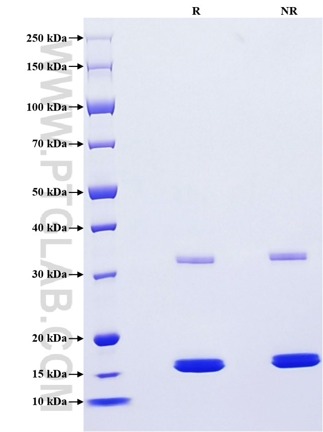 Purity of Recombinant Human Prealbumin was determined by SDS-PAGE. The protein was resolved in an SDS-PAGE in reducing (R) and non-reducing (NR) conditions and stained using Coomassie blue. Purity of Recombinant Human Prealbumin was determined by SDS-PAGE. The protein was resolved in an SDS-PAGE in reducing (R) and non-reducing (NR) conditions and stained using Coomassie blue.