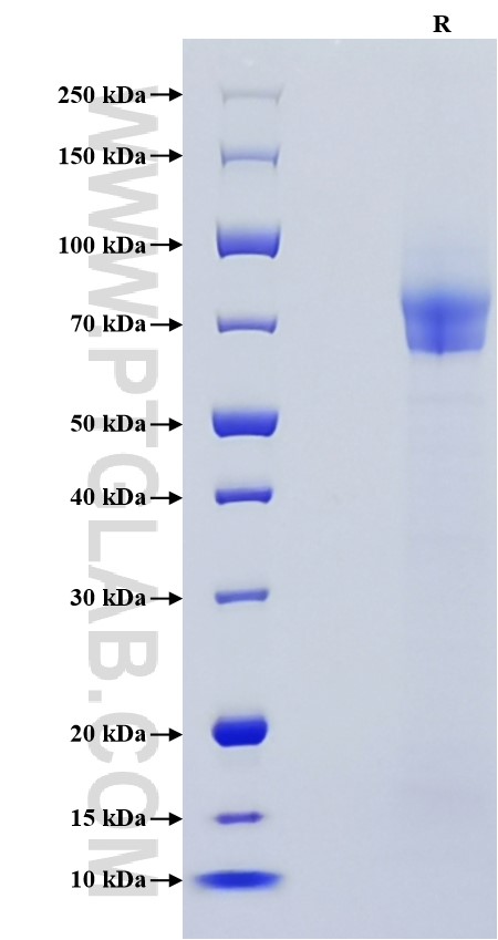 Purity of Recombinant Human Thrombomodulin was determined by SDS-PAGE. The protein was resolved in an SDS-PAGE in reducing (R) conditions and stained using Coomassie blue.