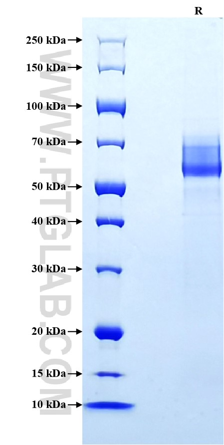 Purity of Recombinant Rat IFN-gamma R1 was determined by SDS-PAGE. The protein was resolved in an SDS-PAGE in reducing (R) conditions and stained using Coomassie blue.