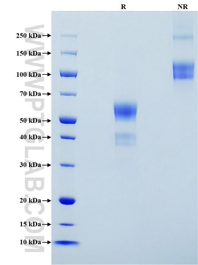 Purity of Recombinant Human CD28 was determined by SDS-PAGE. The protein was resolved in an SDS-PAGE in reducing (R) and non-reducing (NR) conditions and stained using Coomassie blue.