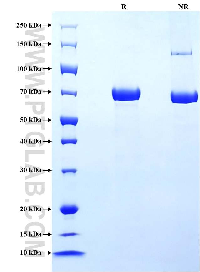 Purity of Recombinant Mouse E-Cadherin was determined by SDS-PAGE. The protein was resolved in an SDS-PAGE in reducing (R) and non-reducing (NR) conditions and stained using Coomassie blue.