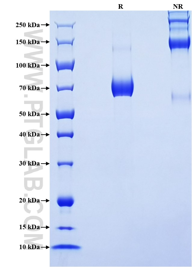Purity of Recombinant Mouse PD-L1 was determined by SDS-PAGE. The protein was resolved in an SDS-PAGE in reducing (R) and non-reducing (NR) conditions and stained using Coomassie blue.