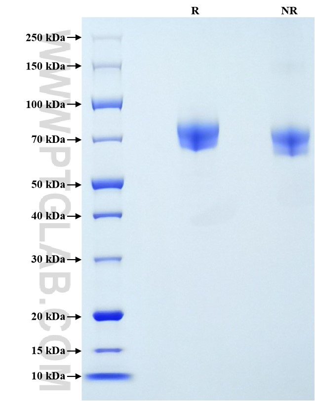 Purity of Recombinant Rat ICAM-1 was determined by SDS-PAGE. The protein was resolved in an SDS-PAGE in reducing (R) and non-reducing (NR) conditions and stained using Coomassie blue.