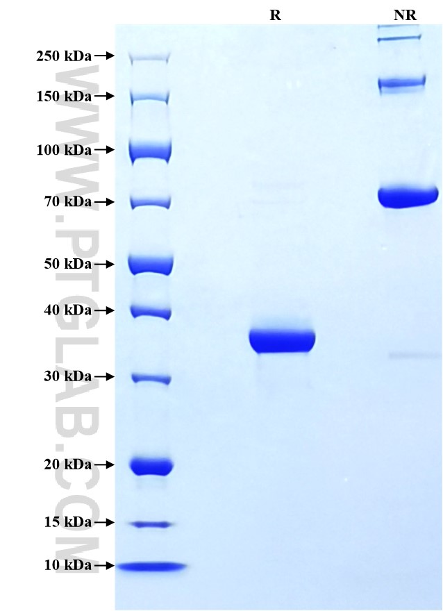Purity of Recombinant Human CD81 was determined by SDS-PAGE. The protein was resolved in an SDS-PAGE in reducing (R) and non-reducing (NR) conditions and stained using Coomassie blue. Purity of Recombinant Human CD81 was determined by SDS-PAGE. The protein was resolved in an SDS-PAGE in reducing (R) and non-reducing (NR) conditions and stained using Coomassie blue.