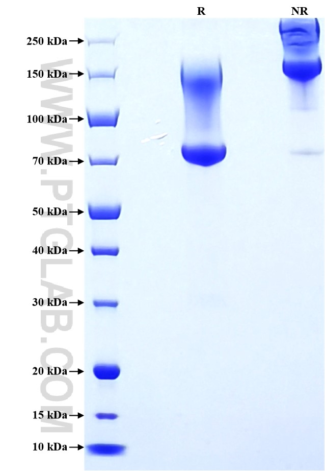 Purity of Recombinant Human MUC1 was determined by SDS-PAGE. The protein was resolved in an SDS-PAGE in reducing (R) and non-reducing (NR) conditions and stained using Coomassie blue. Purity of Recombinant Human MUC1 was determined by SDS-PAGE. The protein was resolved in an SDS-PAGE in reducing (R) and non-reducing (NR) conditions and stained using Coomassie blue.
