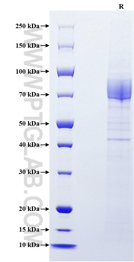 Purity of Recombinant Human CD36 was determined by SDS-PAGE. The protein was resolved in an SDS-PAGE in reducing (R) conditions and stained using Coomassie blue.