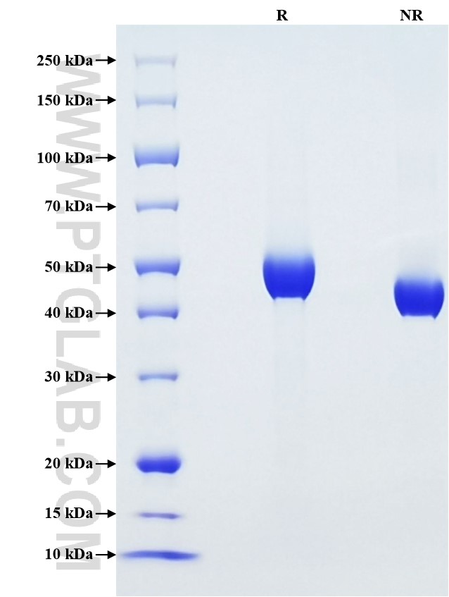 Purity of Recombinant Human CD5 was determined by SDS-PAGE. The protein was resolved in an SDS-PAGE in reducing (R) and non-reducing (NR) conditions and stained using Coomassie blue.
