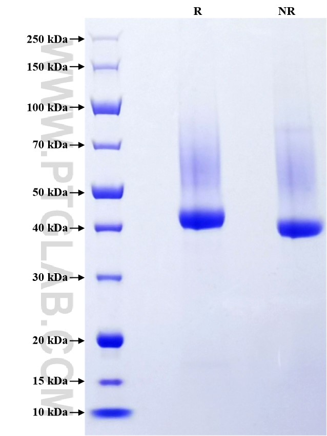 Purity of Recombinant Rat AGER was determined by SDS-PAGE. The protein was resolved in an SDS-PAGE in reducing (R) and non-reducing (NR) conditions and stained using Coomassie blue.