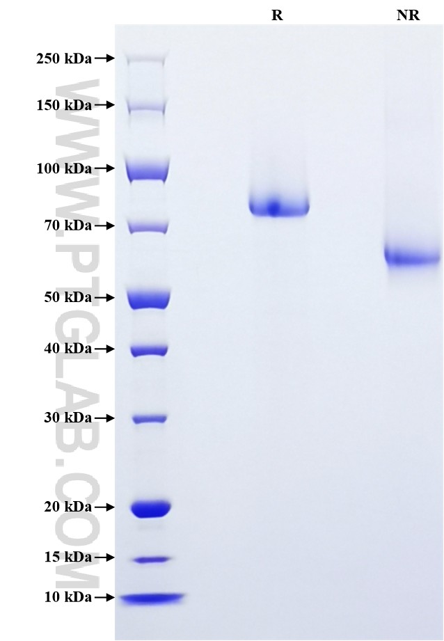 Purity of Recombinant Mouse Thrombomodulin was determined by SDS-PAGE. The protein was resolved in an SDS-PAGE in reducing (R) and non-reducing (NR) conditions and stained using Coomassie blue.