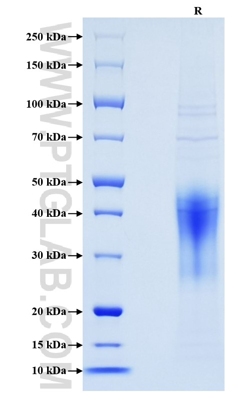 Purity of Recombinant Human IL-18BP was determined by SDS-PAGE. The protein was resolved in an SDS-PAGE in reducing (R) conditions and stained using Coomassie blue.